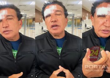 [SENADOR] Magno Malta é hospitalizado com ferimentos no rosto após vidro de banheiro quebrar