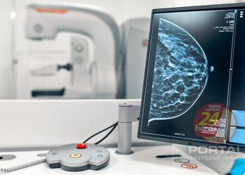 [Outubro Rosa] Mamografias realizadas diminuíram durante a pandemia. Exame é fundamental para detecção precoce