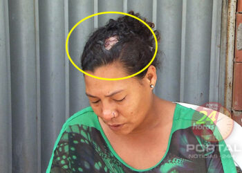 [Feminicídio] Mulher é agredida com marretada na cabeça pelo companheiro no ES