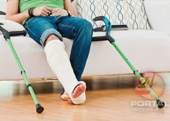 Advogada aponta três sequelas que dão direito ao auxílio-acidente