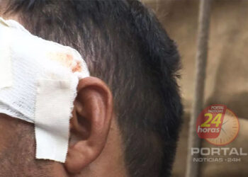 [Desentendimento] Homem é alvejado com dois tiros na cabeça em Piúma, mas não corre risco de morte