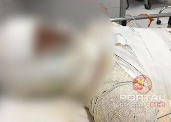 [Guarapari] Adolescente trans é internada em estado grave no ES com sinais de agressão e queimaduras